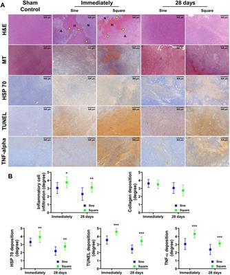 Radiofrequency ablation with sine and square electrical waveforms to enhance ablation range